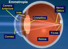 Emmetropia